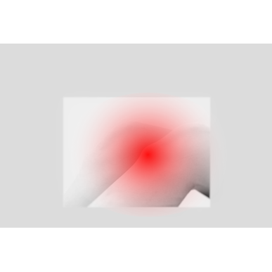 ふじみ野でオスグッドの施術は当整骨院へお任せください