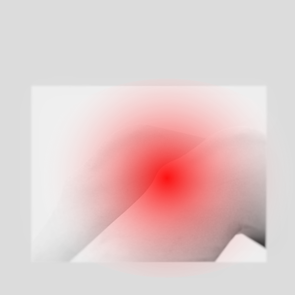 ふじみ野でオスグッドの施術は当整骨院へお任せください